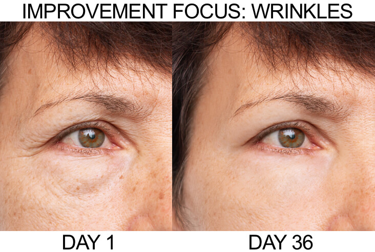 wrinkles_example